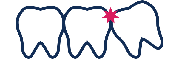 ����� ��ġ